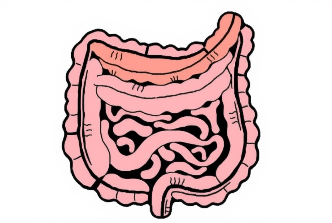 Diagram showing digestive tract with diverticula