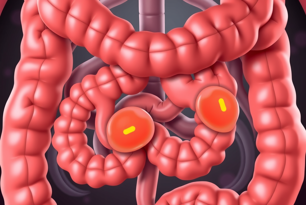 Post cover image
